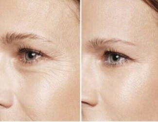 提前衰老、抵抗力差，用熟三七粉，抗衰還能補氣血！